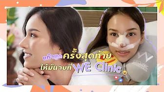 รีวิวแก้จมูก ทำจากที่อื่นมาสองครัั้ง จบที่ WE Clinic