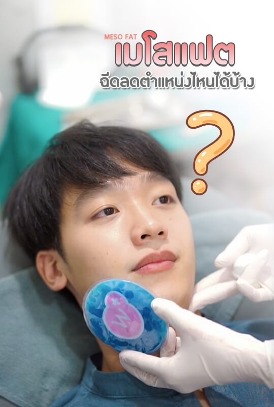 ฉีดเมโสแฟต ตำแหน่งไหนได้บ้าง