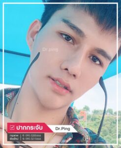 review-man-caltrop-0ถ