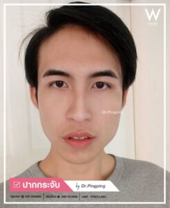 review-man-caltrop-06