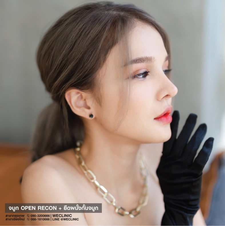 จมูกทรงปลายเชิดธรรมชาติ