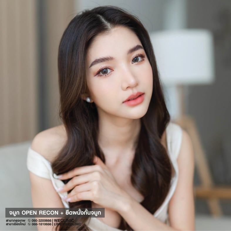 ทรงจมูกธรรมชาติเกาหลี