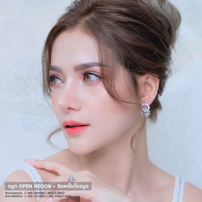 ทรงจมูกสายฝอแบบธรรมชาติ