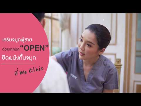 เสริมจมูกผู้ชาย ด้วยเทคนิค OPEN ยืดผนังกั้นจมูก