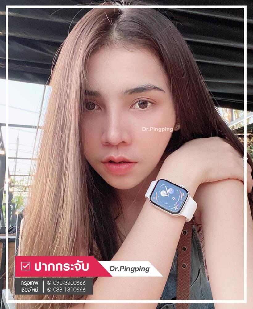 รีวิวปากกระจับ-1