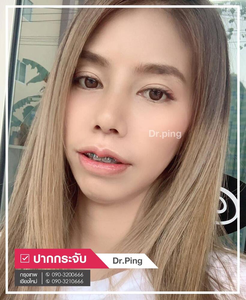 รีวิวปากกระจับ-2