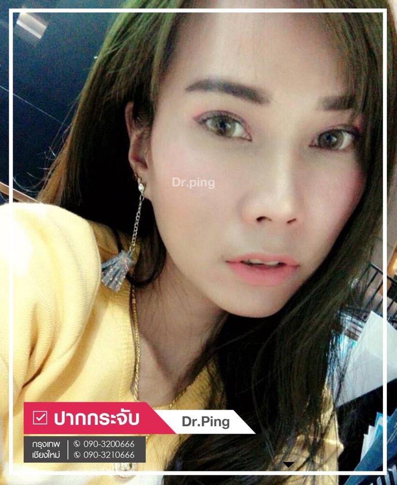 รีวิวปากกระจับ-3