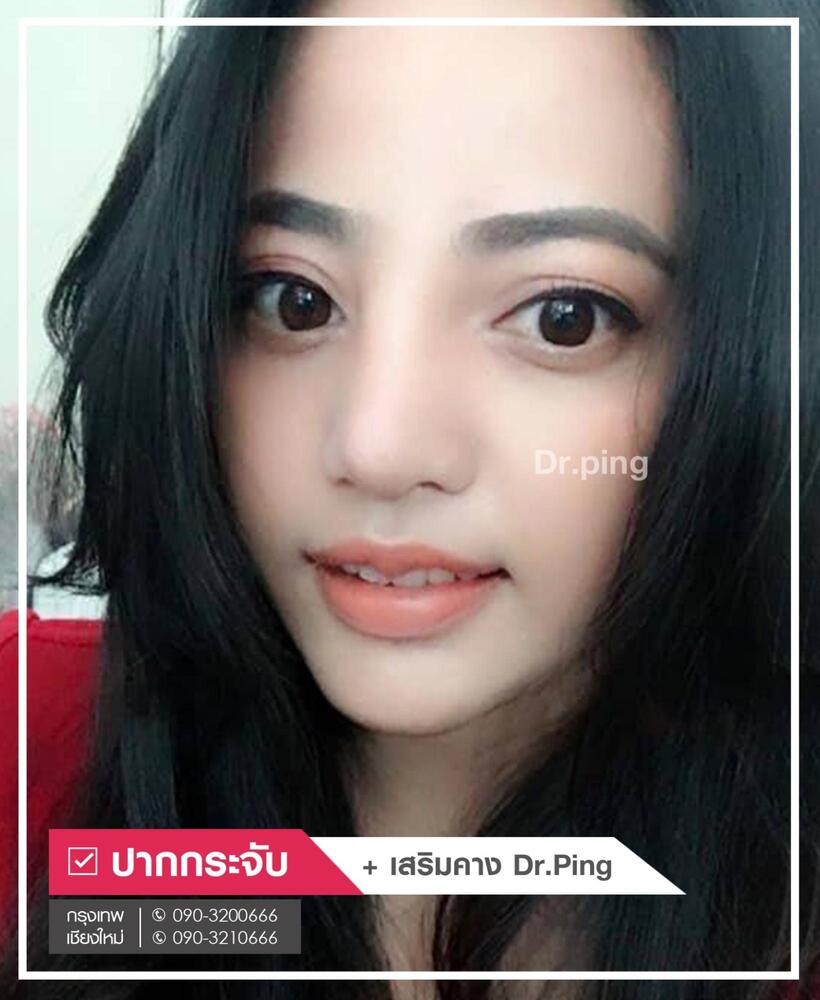 รีวิวปากกระจับ-4