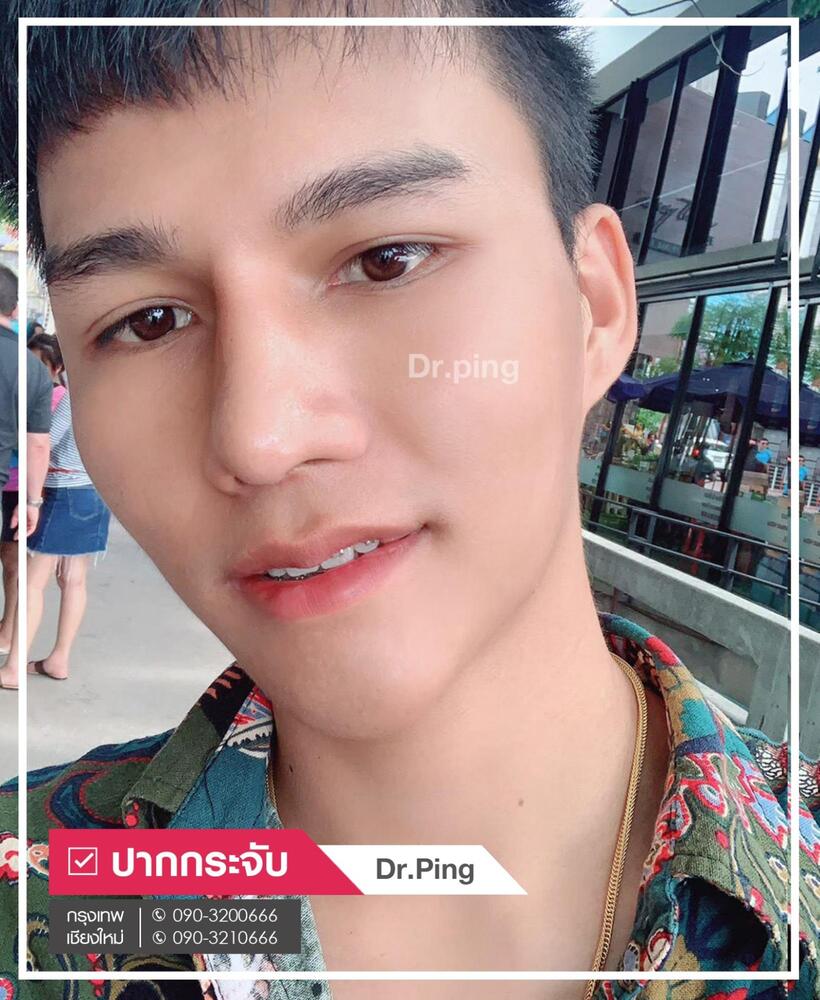 รีวิวปากกระจับ-5