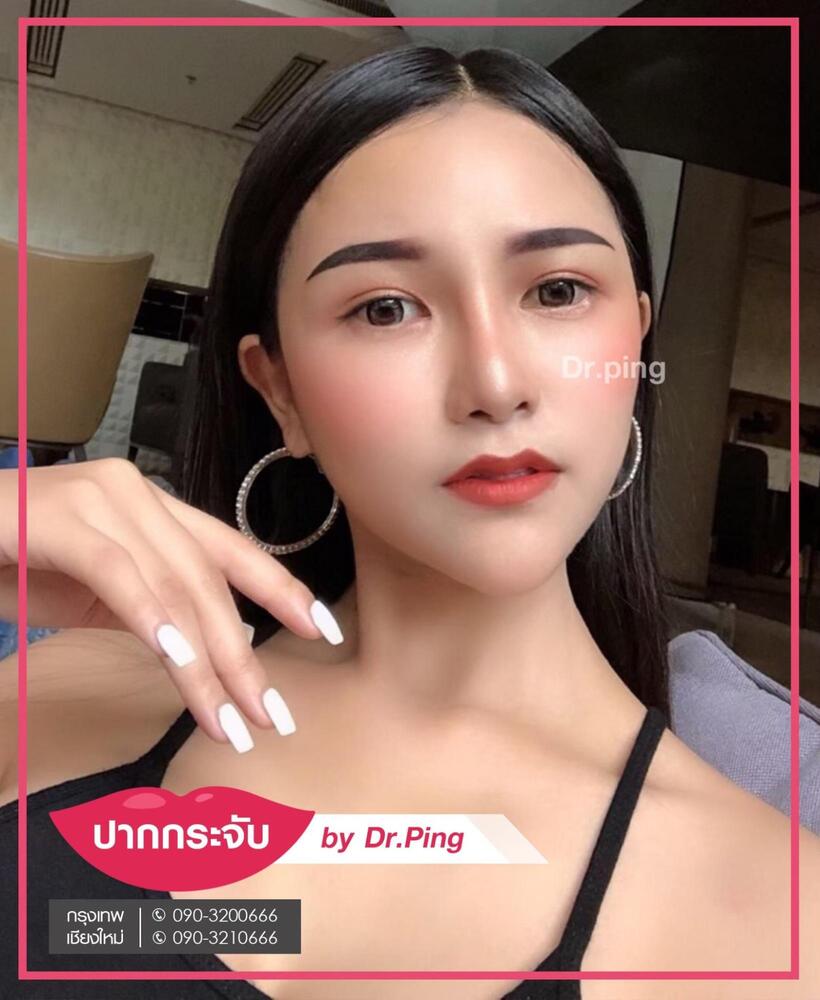 รีวิวปากกระจับ-6