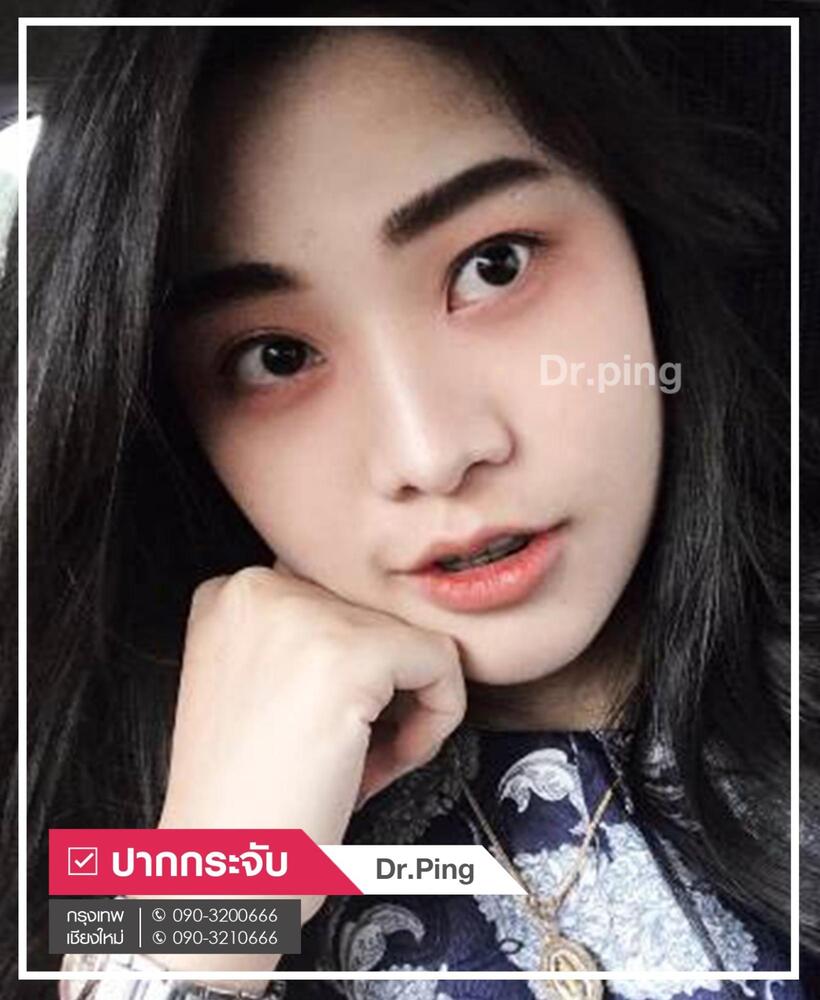 รีวิวปากกระจับ-7