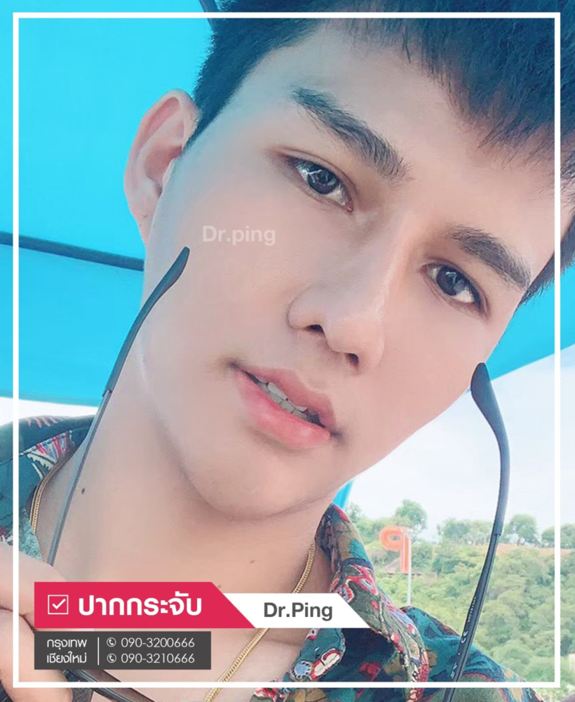 รีวิวปากกระจับผู้ชาย