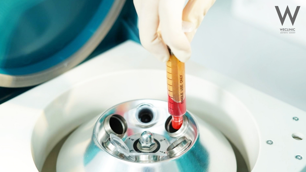 ฉีดไขมันหน้าเด็กในบริเวณที่ต้องการ