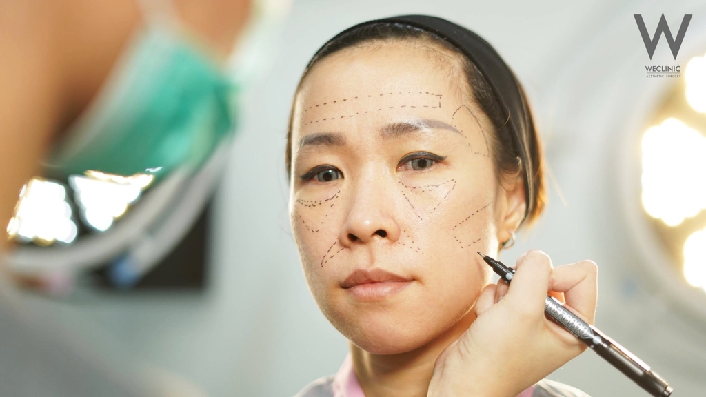 ประเมินว่าใบหน้าก่อนการฉีดไขมันหน้า