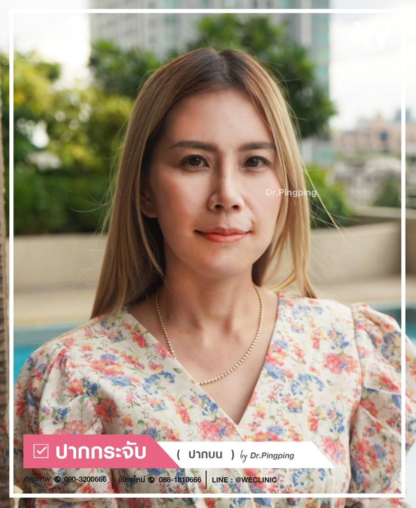 รีวิวปากกระจับ-U3