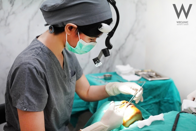 วิธีแก้ไขปากคว่ำโดยการยกมุมปาก