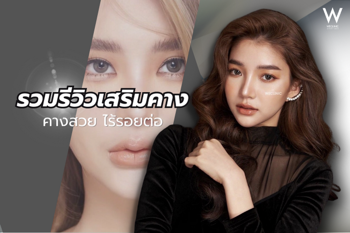 รวมรีวิวทำคาง เสริมคางให้เป็นธรรมชาติ กรอบหน้าชัด V Shape