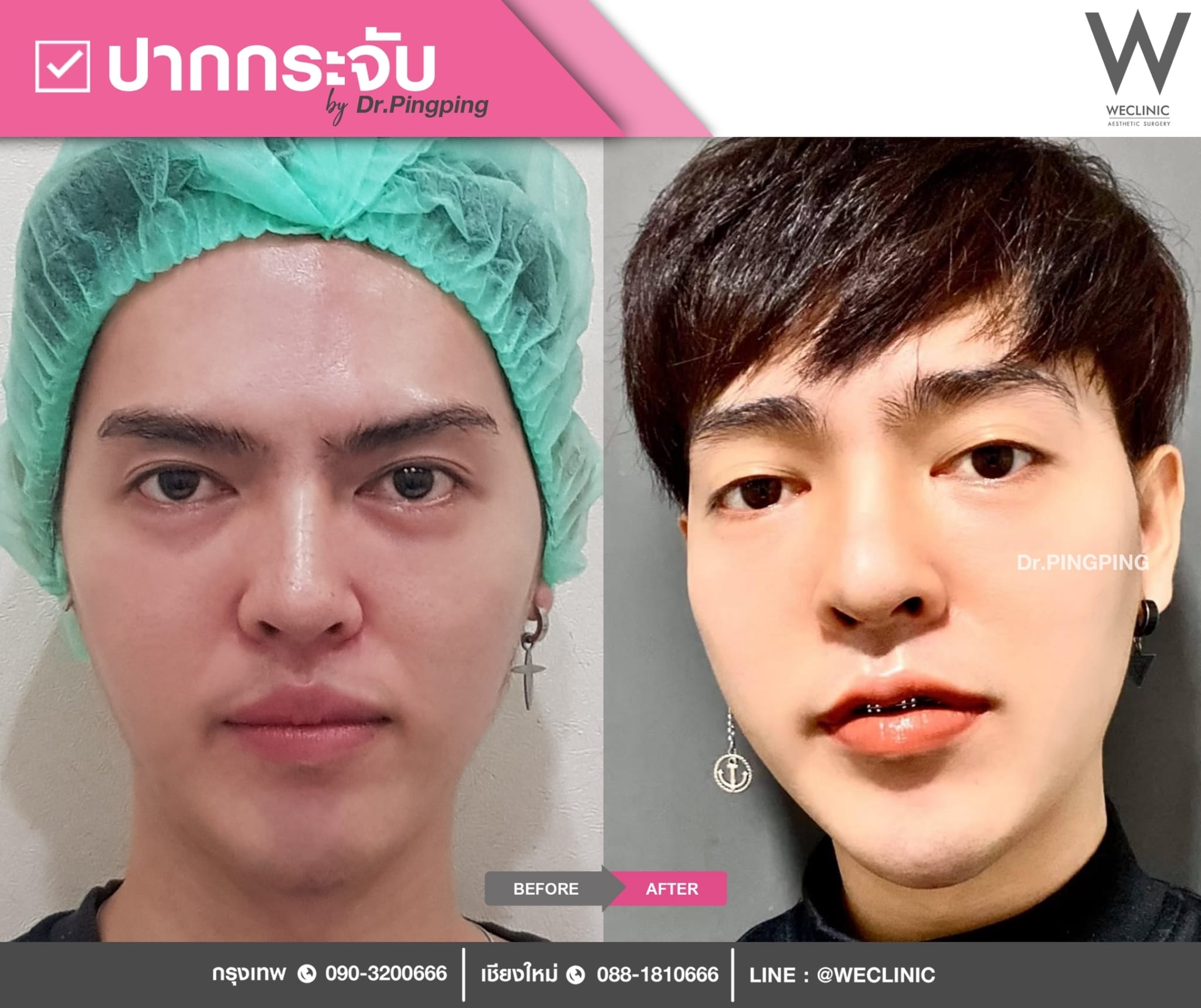 2-ปากกระจับ ผู้ชาย