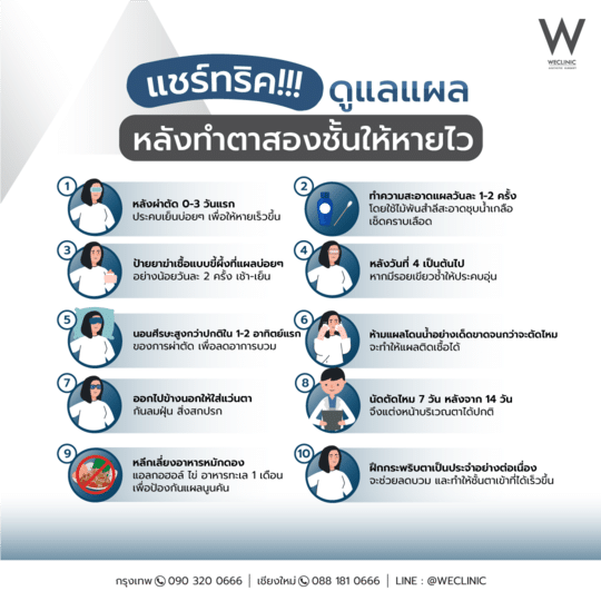 การดูแลหลังทำตาสองชั้นให้หายไว