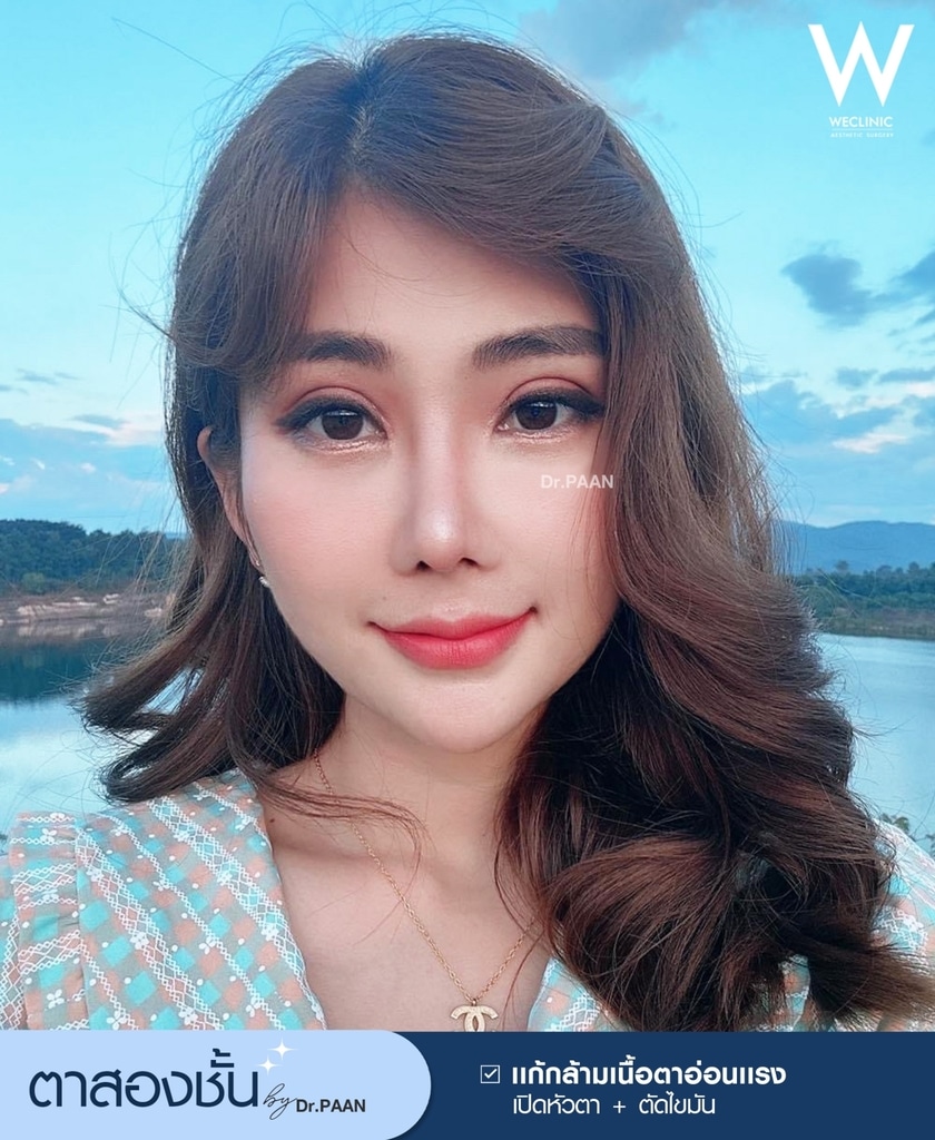 ตาสายฝอ