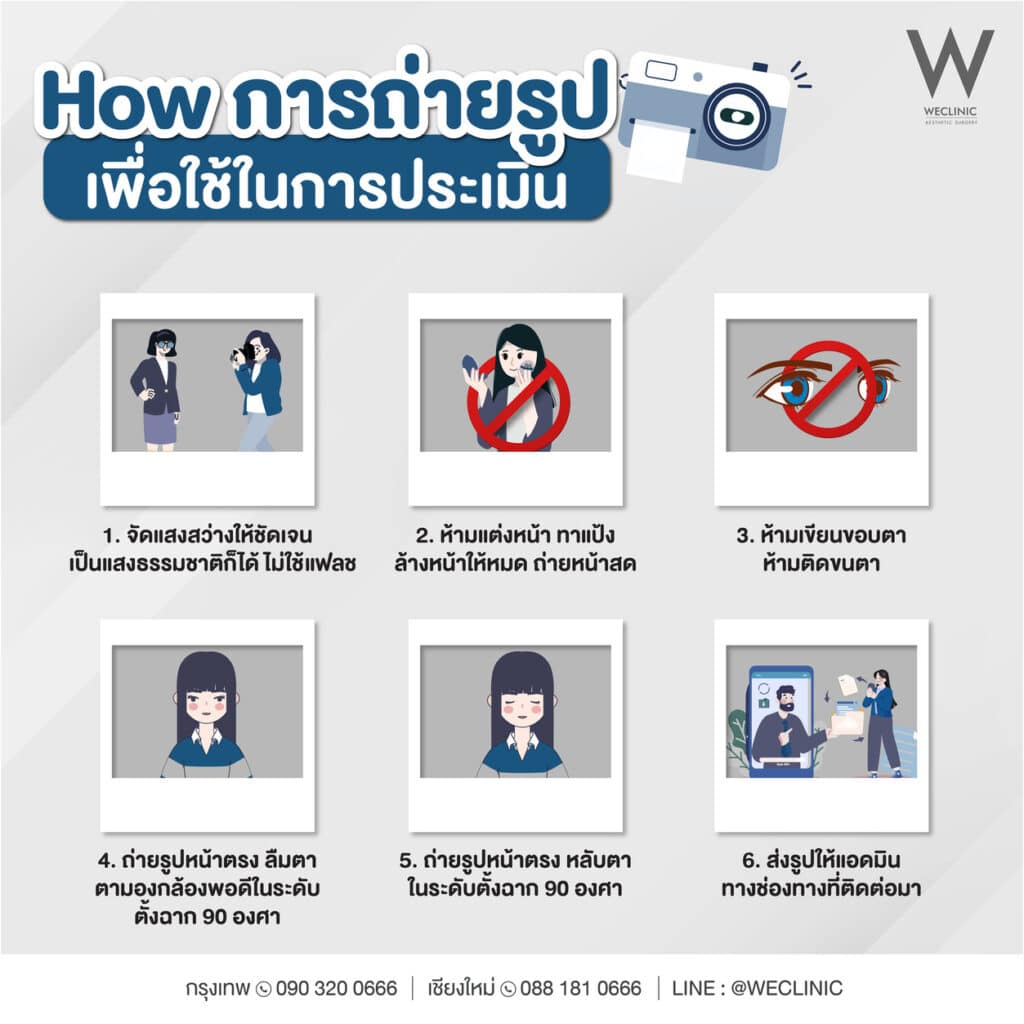 ส่งรูปภาพดวงตามาให้คุณหมอประเมินก่อนทำตาสองชั้น