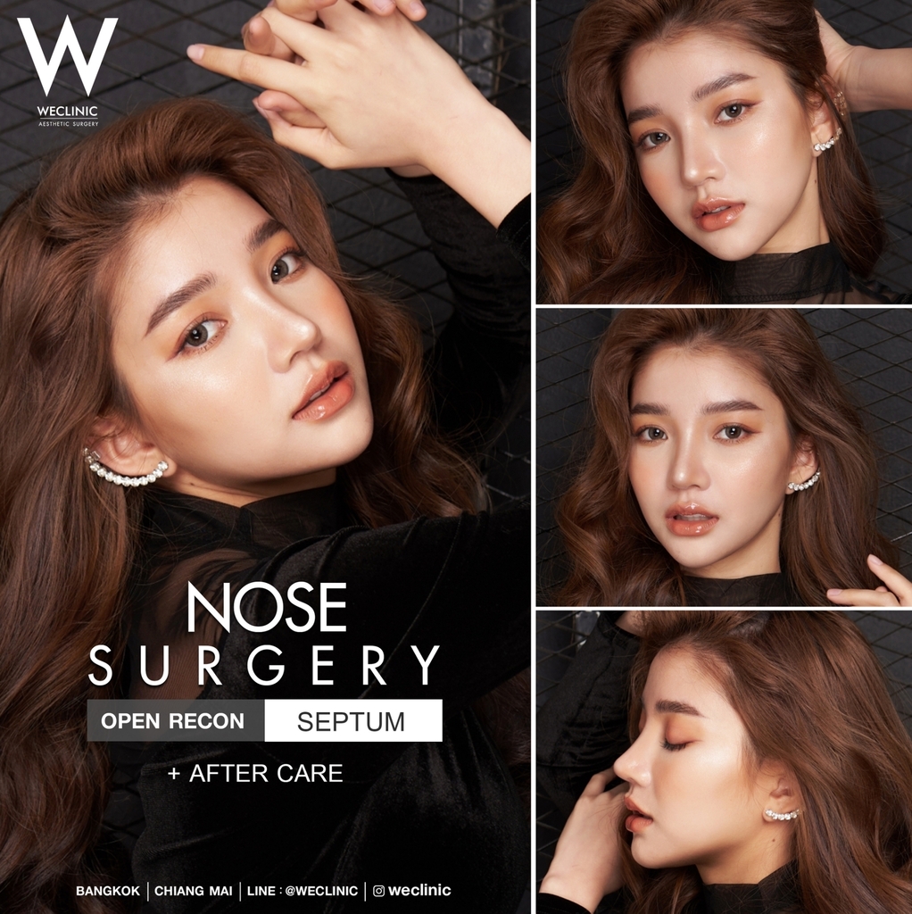 nose surgery review 05