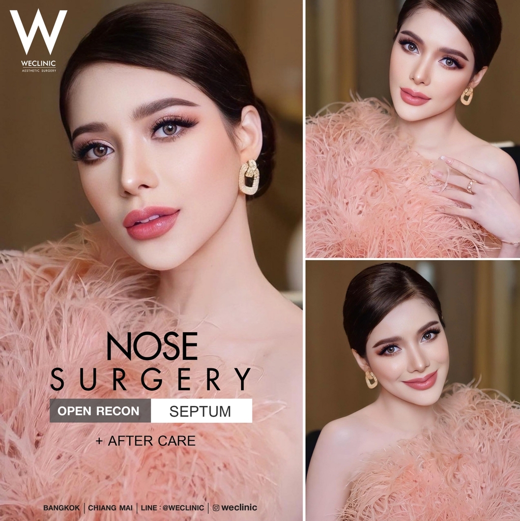 nose surgery review 06
