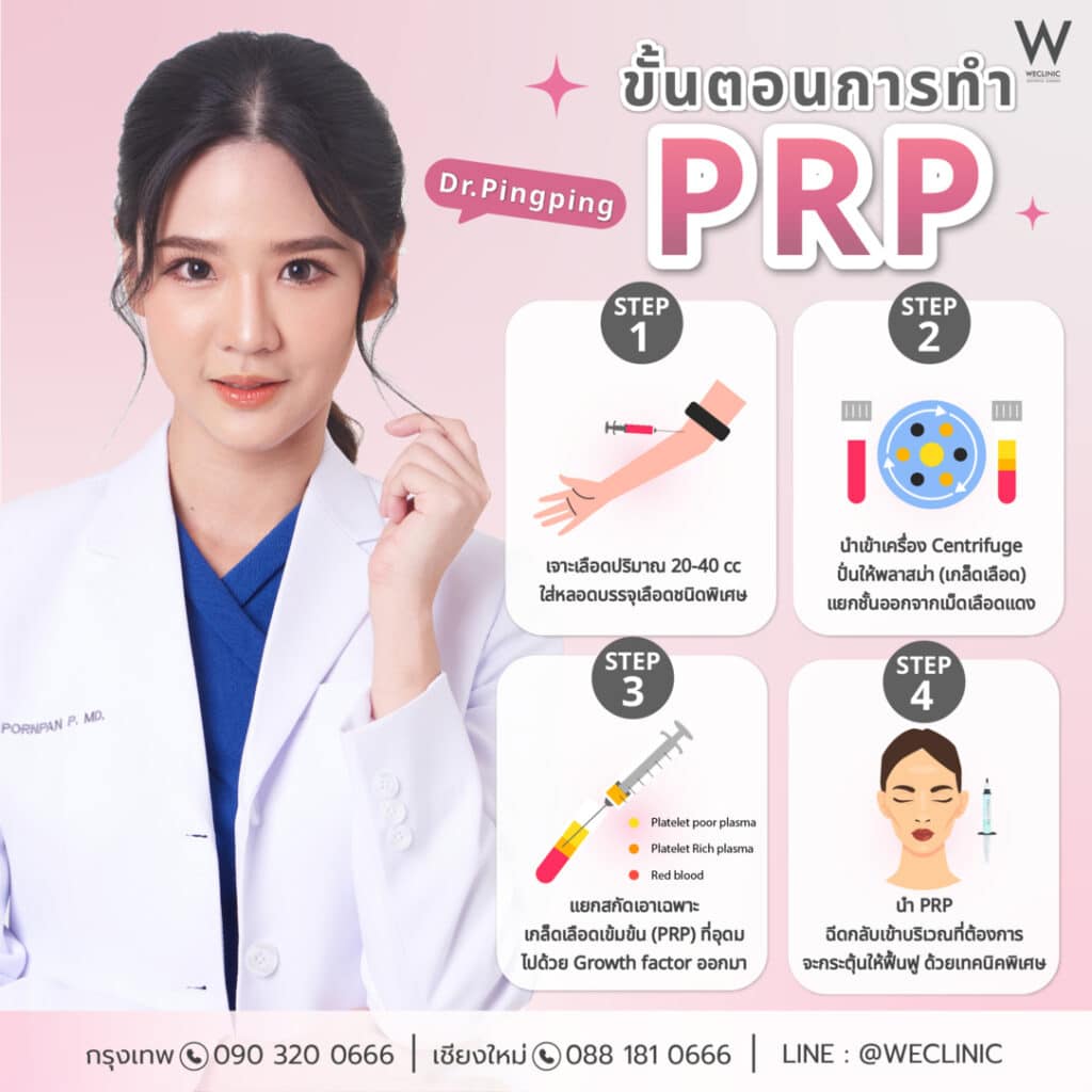 ขั้นตอนการทำ PRP หน้าใส