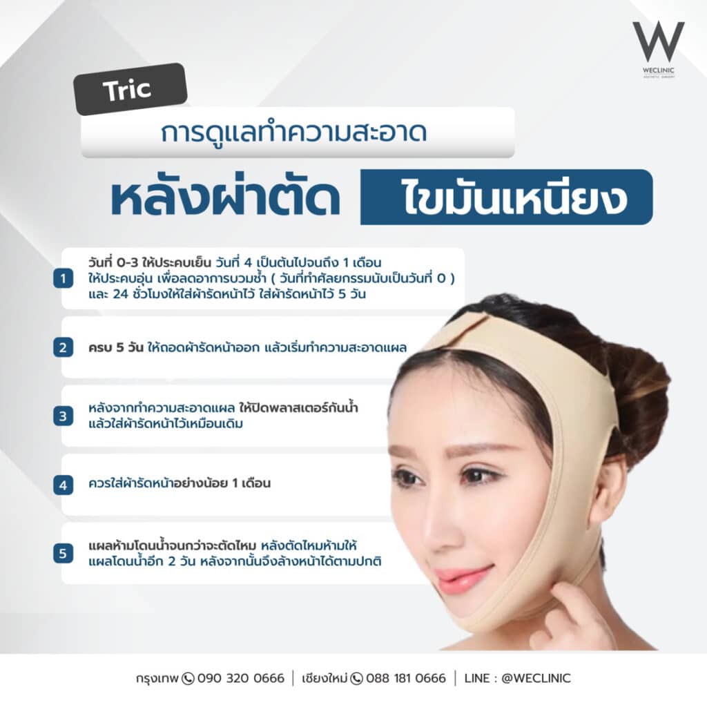 การดูแลหลังผ่าตัดไขมันเหนียง