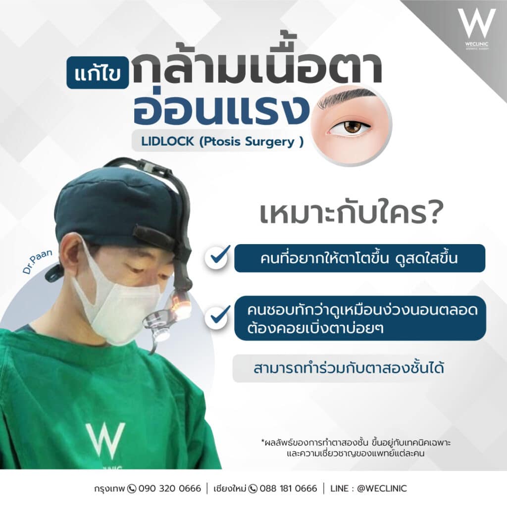 แก้กล้ามเนื้อตาอ่อนแรงเหมาะกับใคร