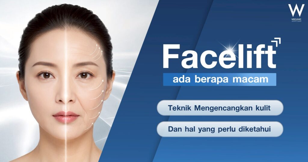 Facelift ada berapa macam