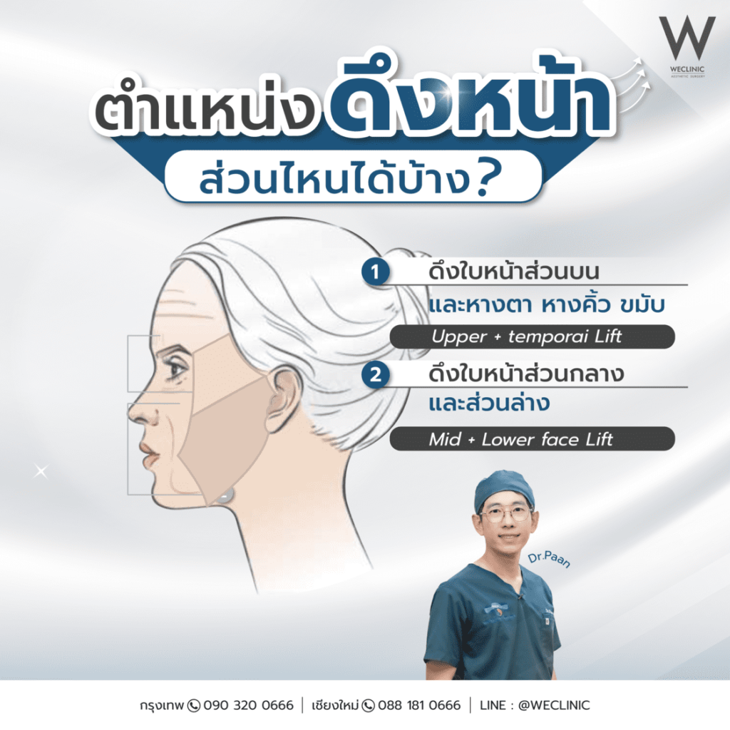 ดึงหน้า ตำแหน่งไหนได้บ้าง