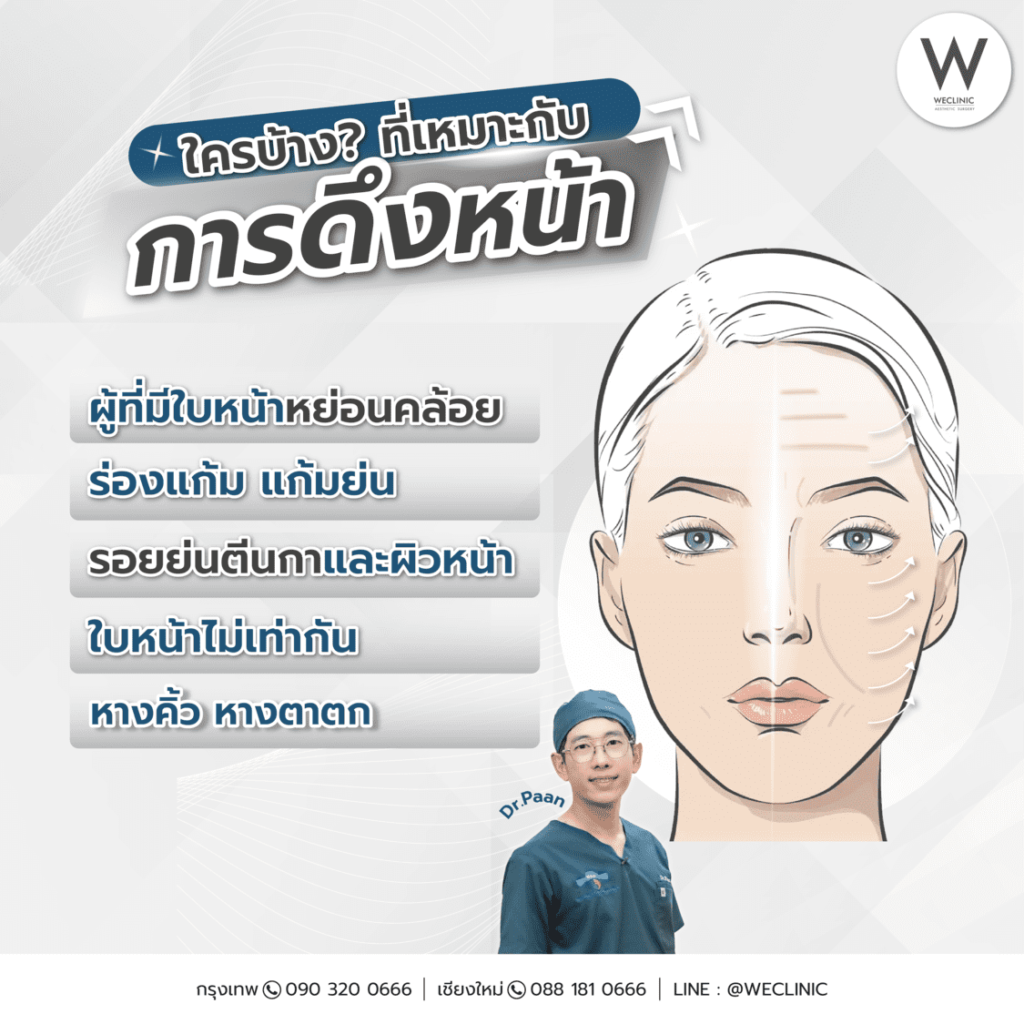 ดึงหน้า เหมาะกับใครบ้าง