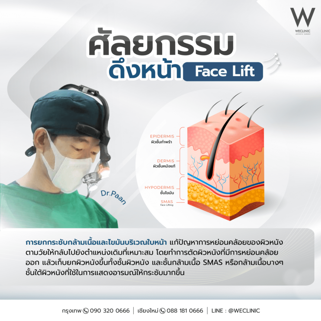 ศัลยกรรมดึงหน้า face lift