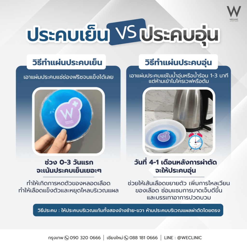 ประคบเย็น vs ประคบอุ่น หลังผ่าตัดศัลยกรรม