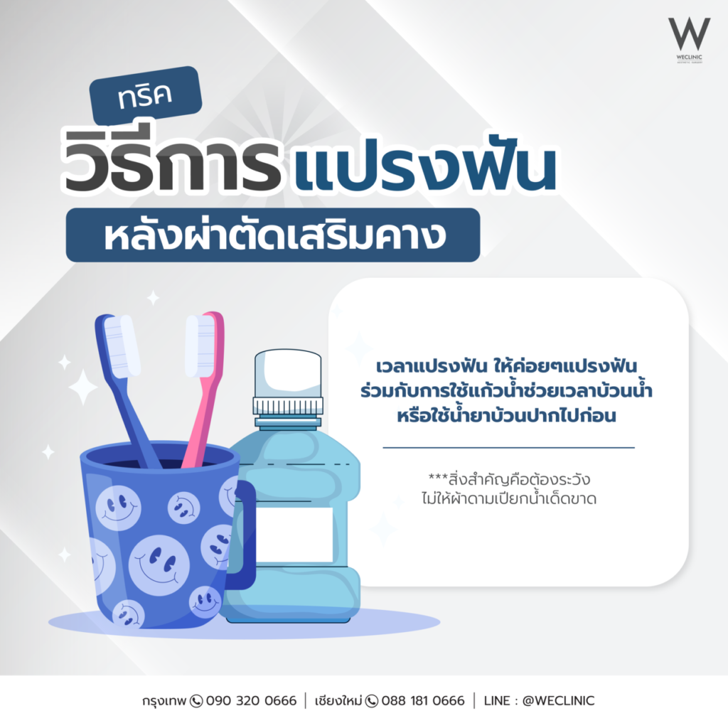 วิธีการแปรงฟันหลังผ่าตัดเสริมคาง