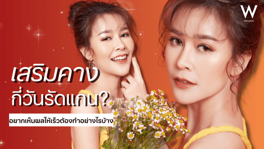 เสริมคางกี่วันรัดแกน