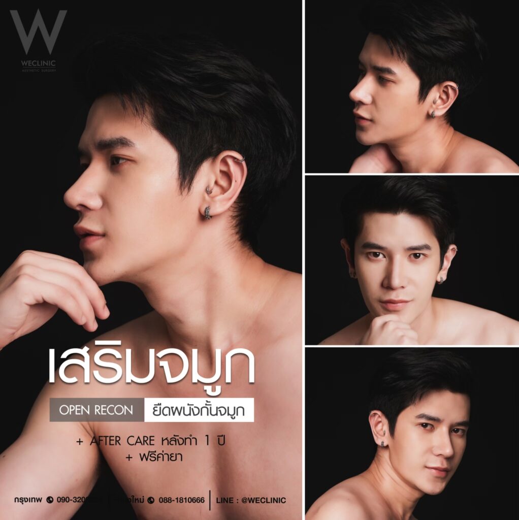 รีวิวทำจมูกผู้ชาย ที่ We Clinic