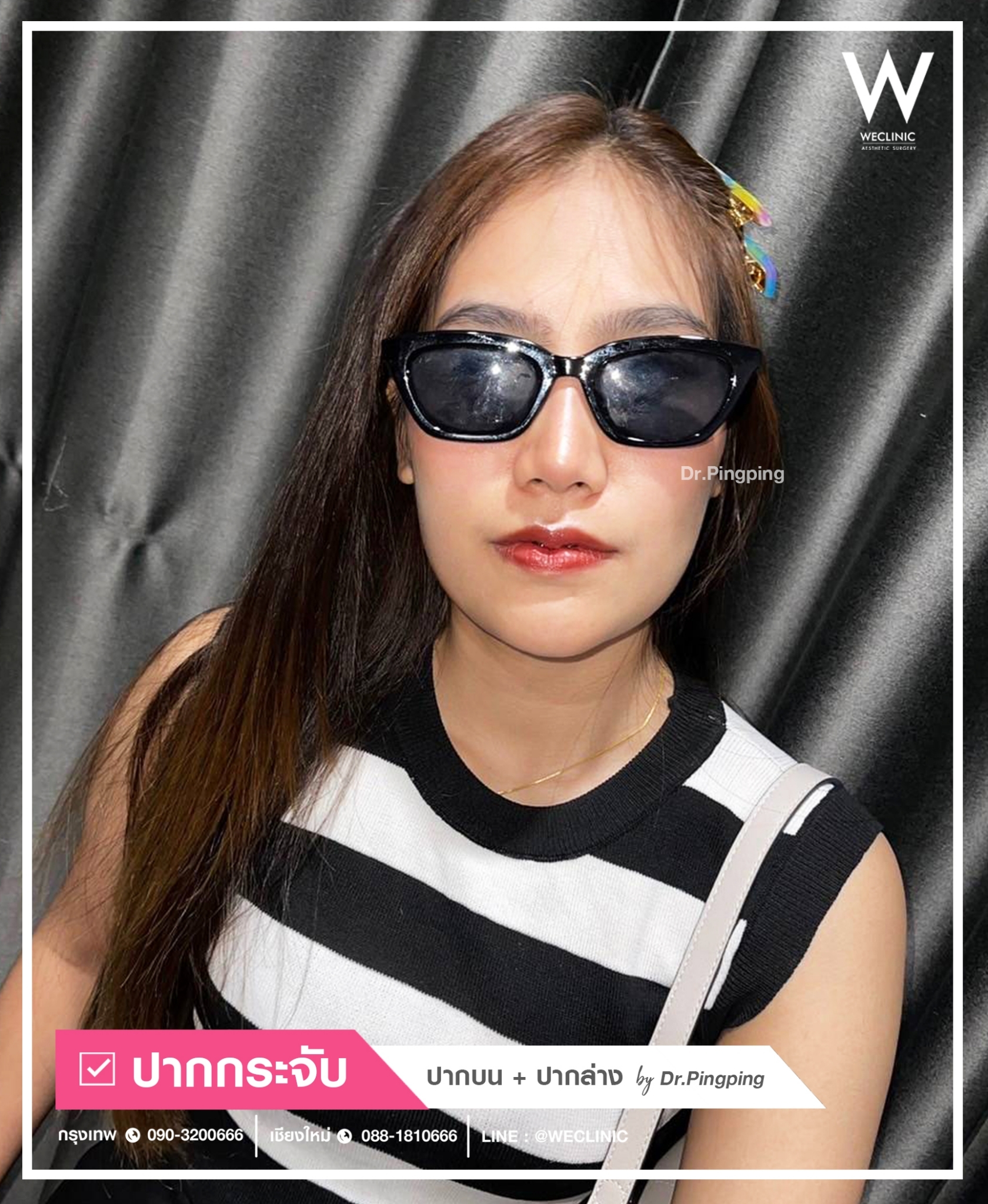 รีวิวปากกระจับ-ปากบน-ปากล่าง