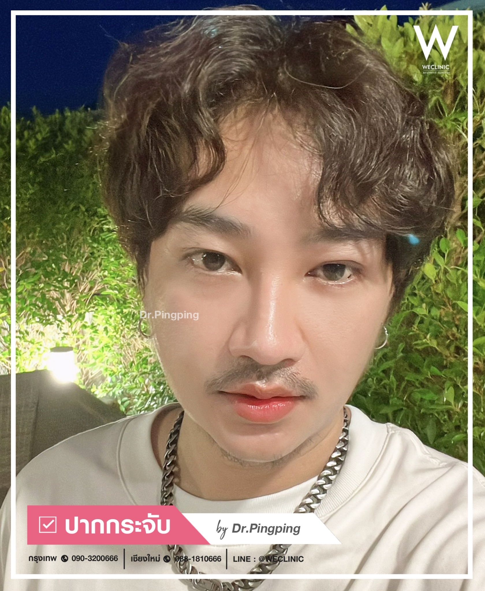 รีวิวปากกระจับ