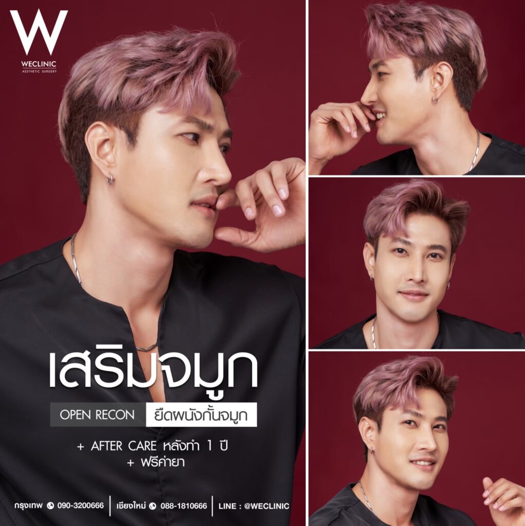 รีวิวเสริมจมูกผู้ชาย ที่ We Clinic