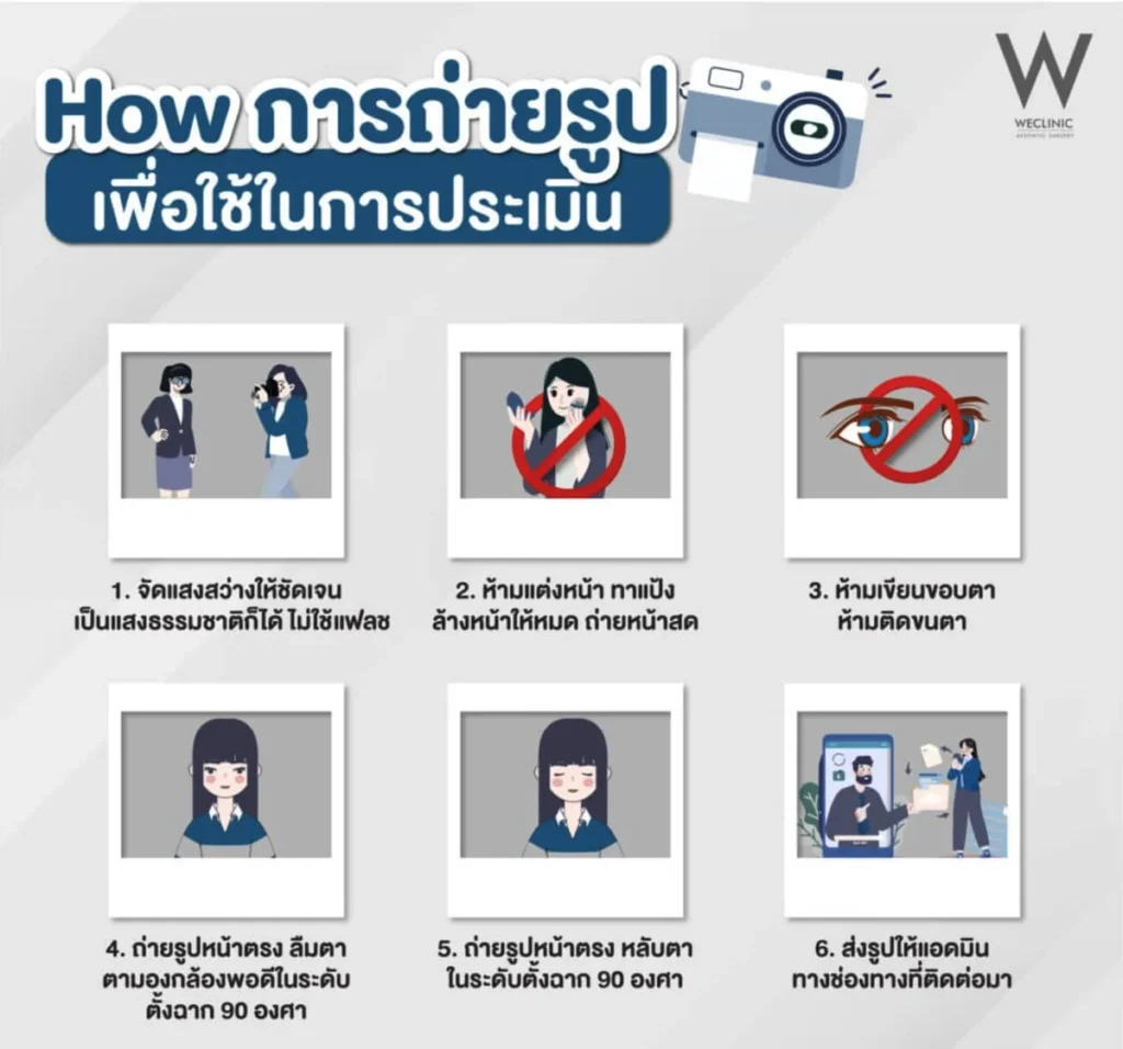 how-to-take-photo-for-eye-assessment