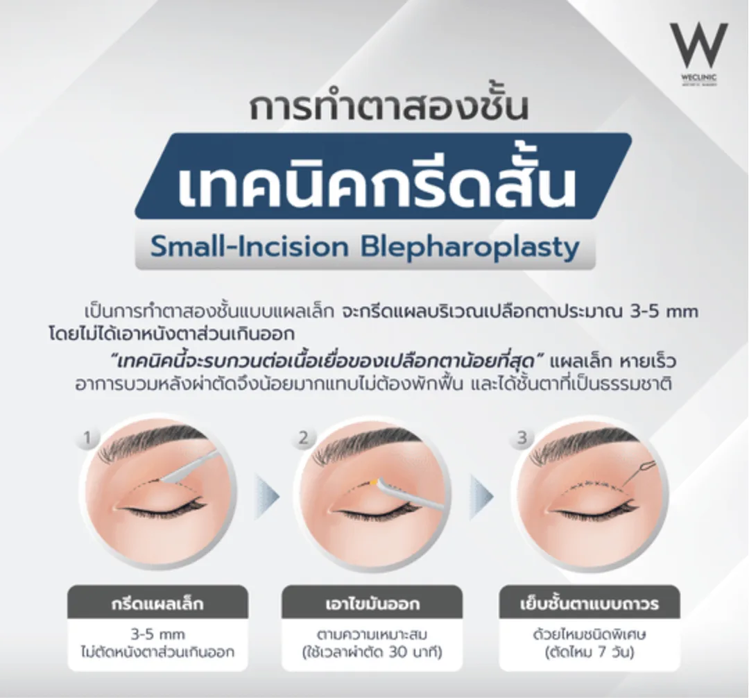 small-incision-blepharoplasty-technique