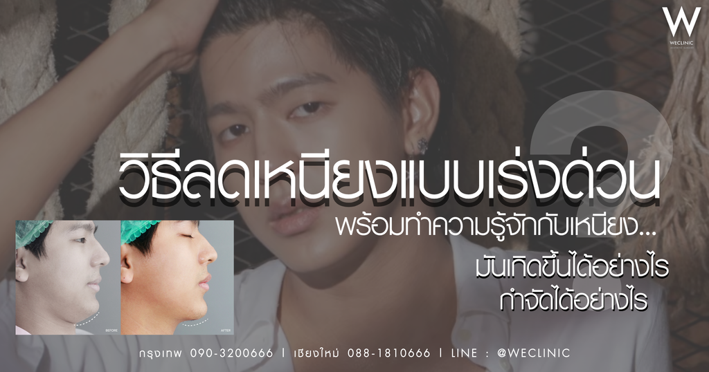 วิธีลดเหนียงใต้คาง มีกี่แบบ ลดใน 7 วัน เห็นผลเร็วทำได้จริงไหม