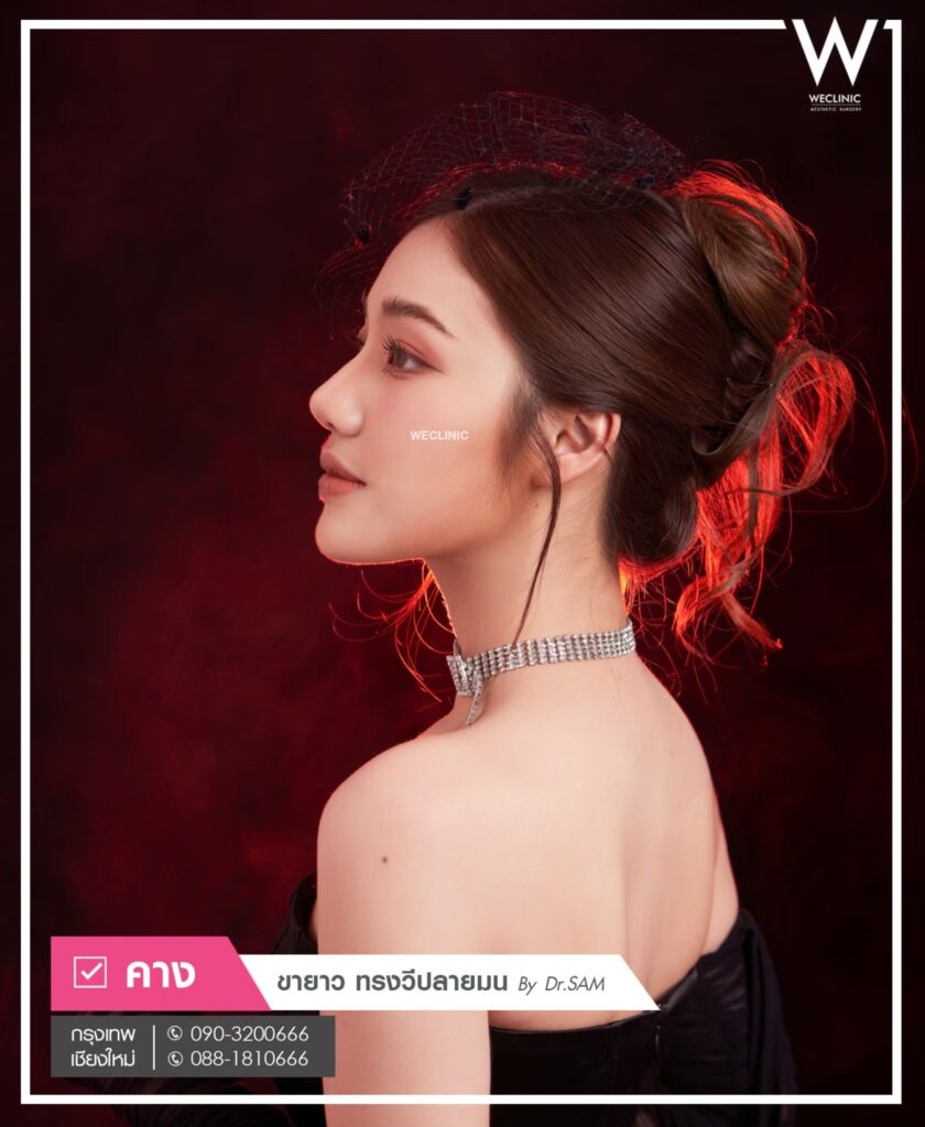 เสริมคางบริเวณแผลนอก เสี่ยงคีลอยด์