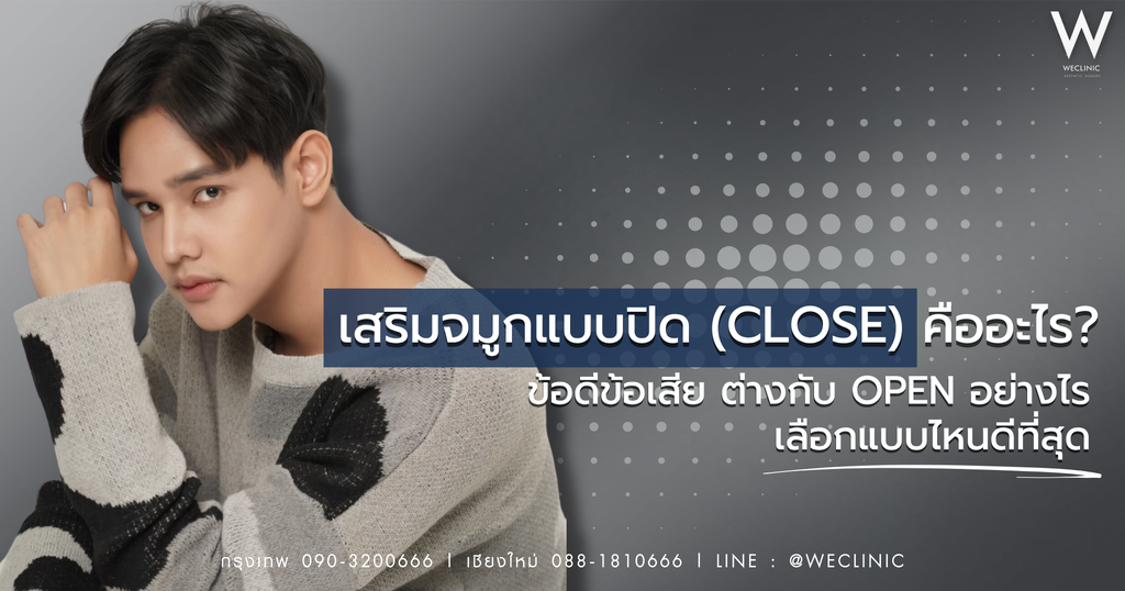 เสริมจมูกแบบปิด (close) คืออะไร ข้อดีข้อเสีย ต่างกับ Open อย่างไร เลือกแบบไหนดีที่สุด