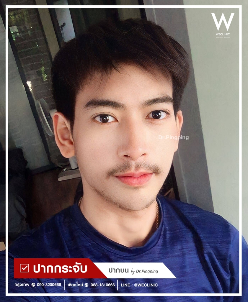 รีวิวปากกระจับ-4