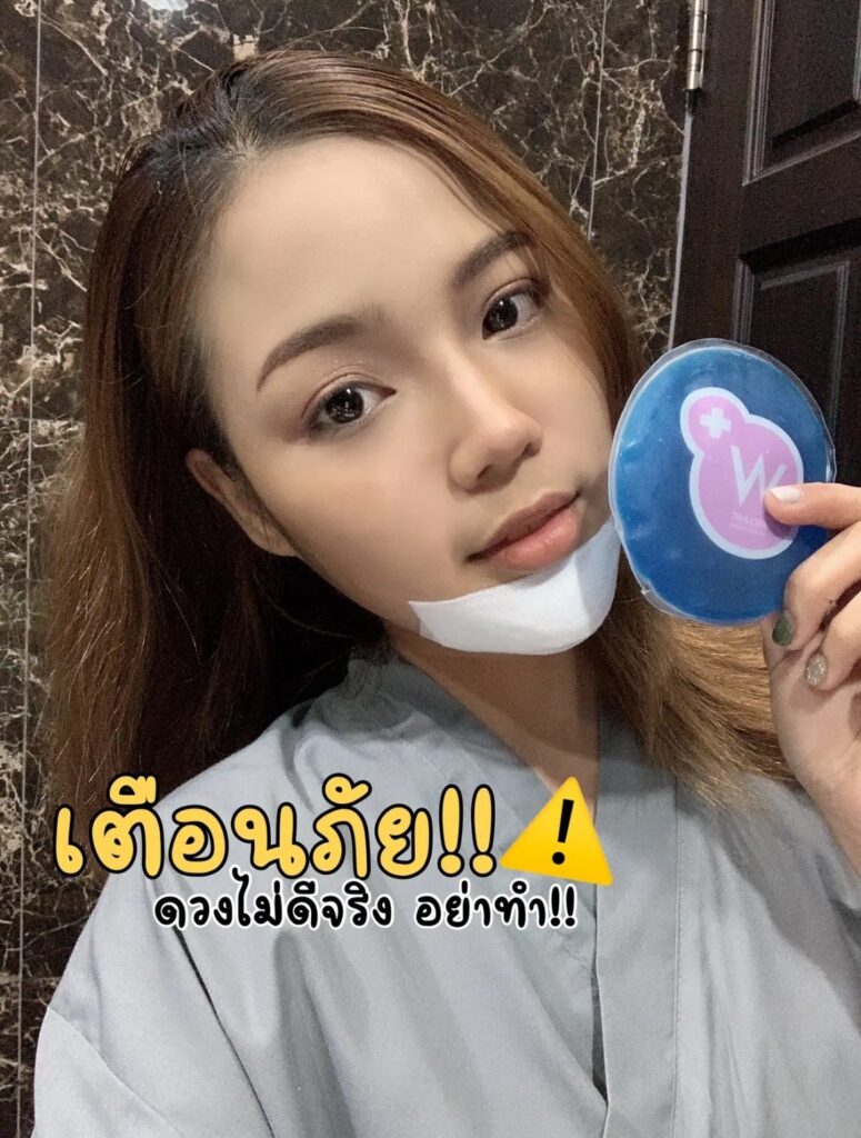 รีวิวหลังเสริมคางกินอาหารแสลง