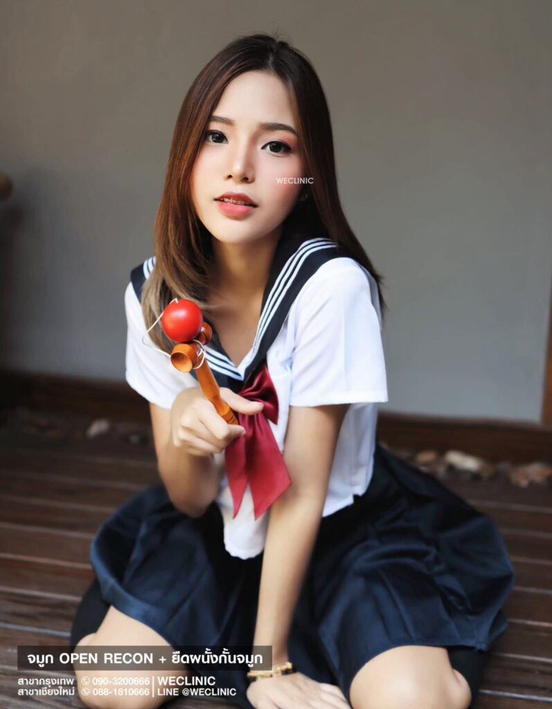 หลังศัลยกรรมคาง จมูก