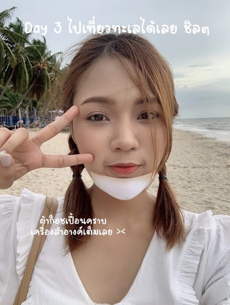 หลังเสริมคางไปเที่ยวทะเล